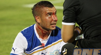 אבוחצירא מדמם לאחר התנגשות ראשים עם ליאור ז´אן (עמית מצפה) אבוחצירא מדמם לאחר התנגשות ראשים עם ליאור ז´אן (עמית מצפה)